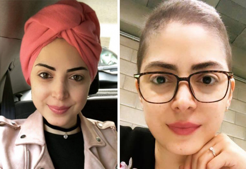 لبنان يودع “محاربة السرطان الجميلة”