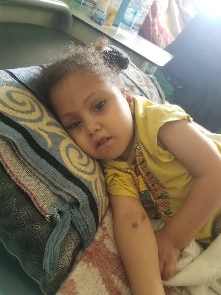 مرضى الكلى الأطفال