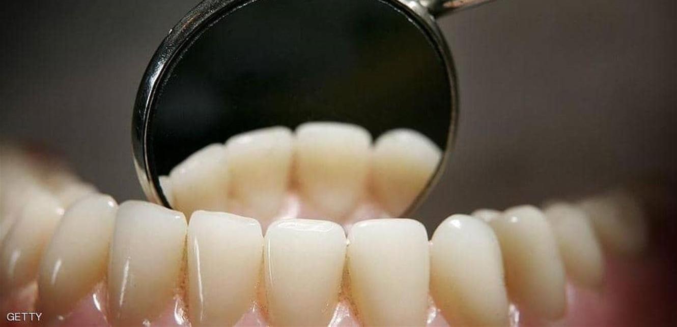 اكتشاف طبي سيغنيكم عن حشو الأسنان