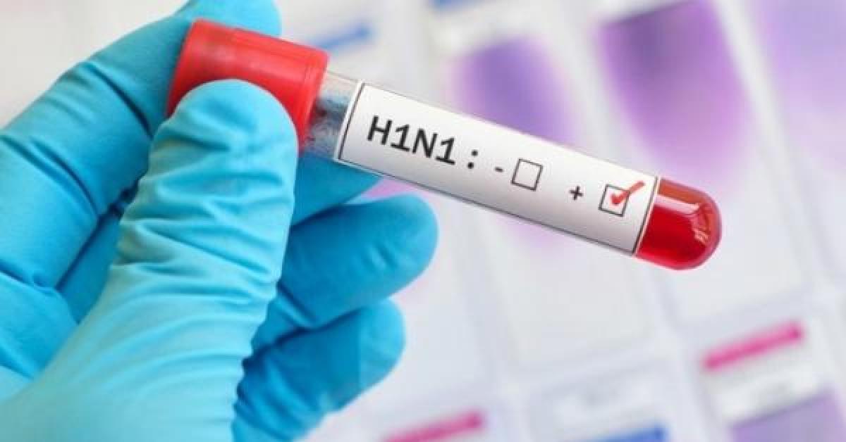وزارة الصحة تدعو المواطنين إلى عدم التخوف من انفلونزا h1n1