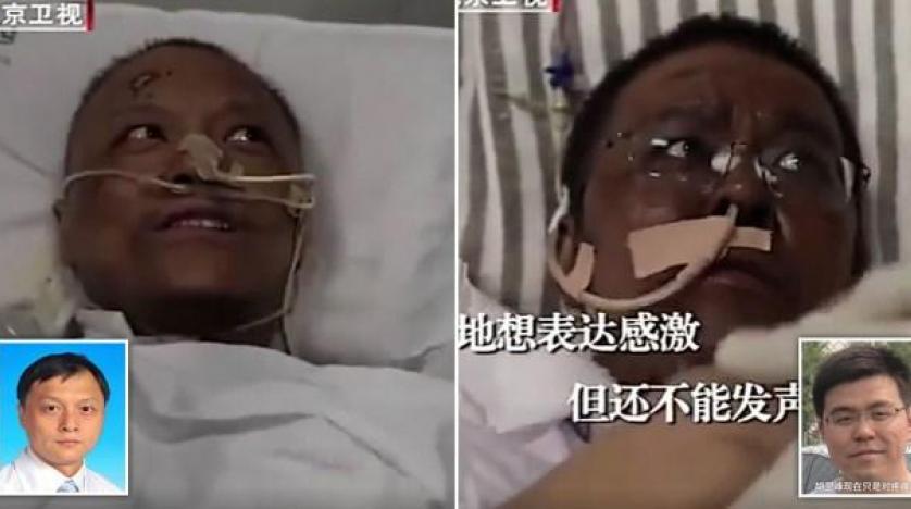 كورونا يحول بشرة طبيبين صينيين إلى اللون الأسود