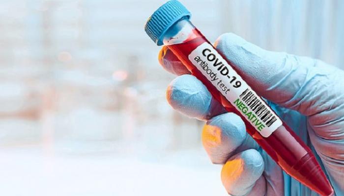 شركة بريطانية تعلن عن نتائج إيجابية لتجربة لقاح مضاد لفيروس كورونا