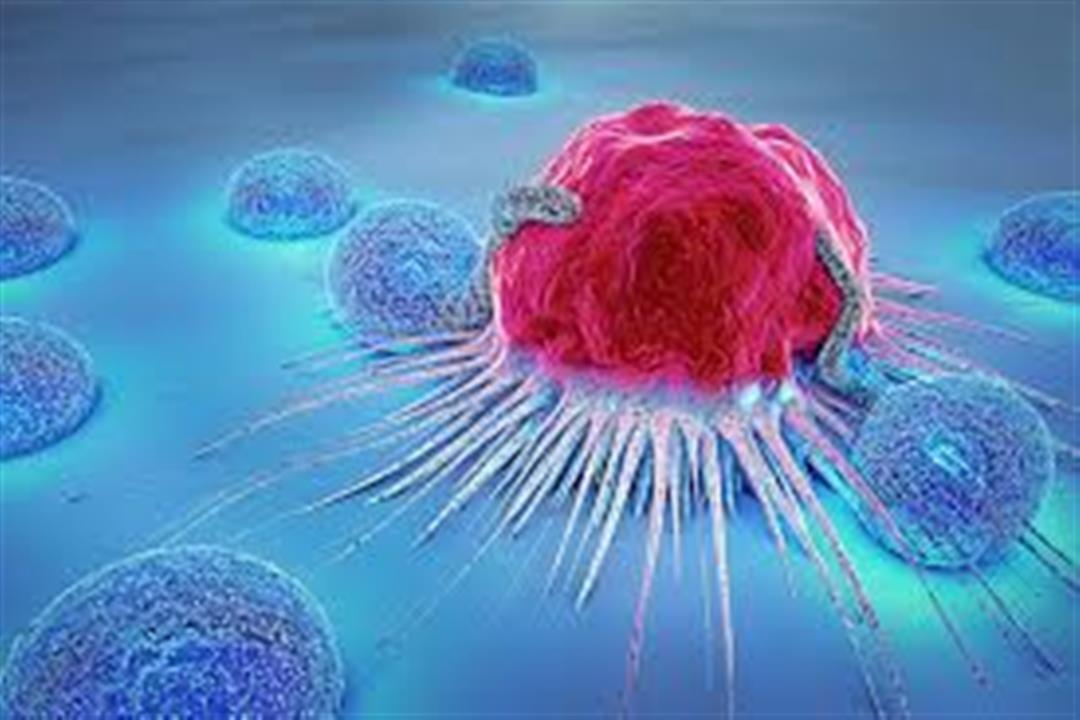 سرطان الثدي الالتهابي.. إليك أسبابه وطرق اكتشافه