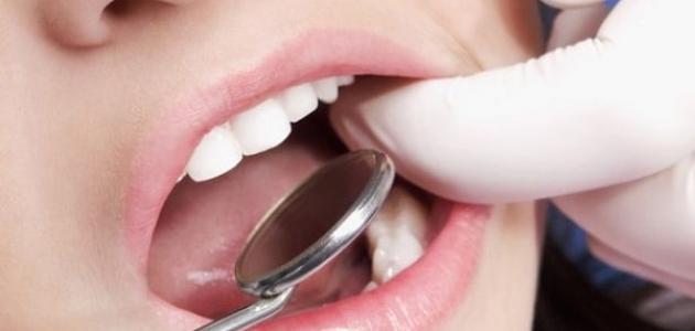 6 نصائح هامة لتجنب الإصابة بسرطان الفم