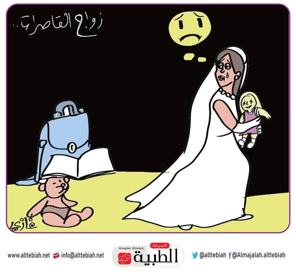 زواج القاصرات في اليمن.. صدمات نفسية عنيفة