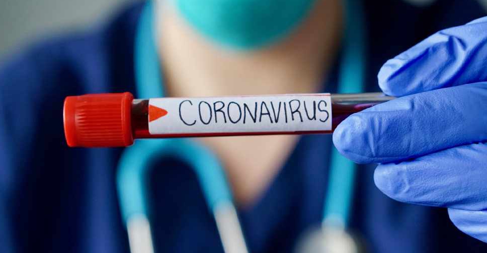 علماء يحددون المصدر الأكثر شيوعا للإصابة بفيروس كورونا