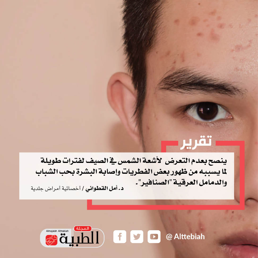  بعدم التعرض لأشعة الشمس - المجلة الطبية