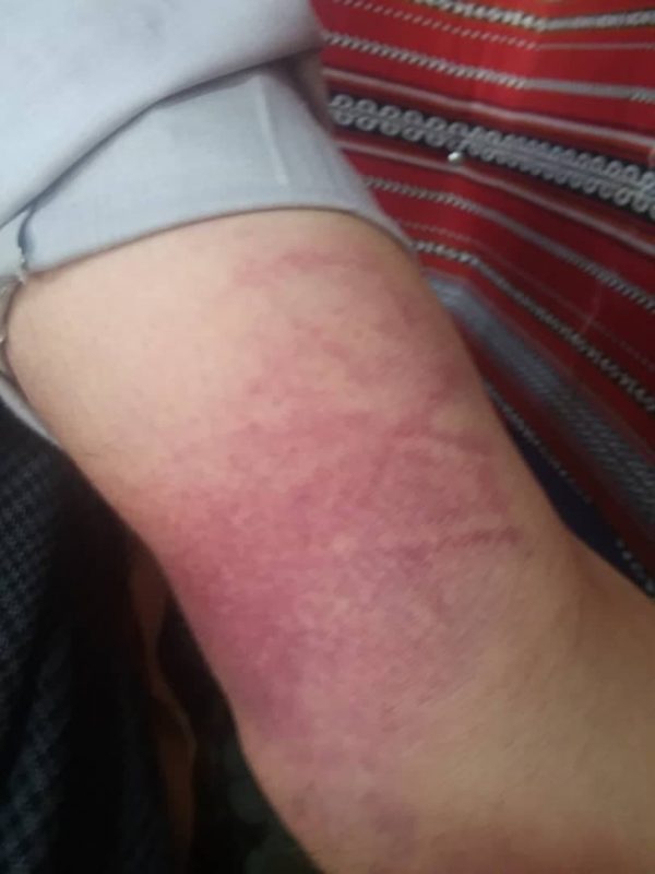 photo ٢٠٢١ ٠٩ ١٨ ٢٠ ٠١ ٤٠ e1631987081124 - المجلة الطبية