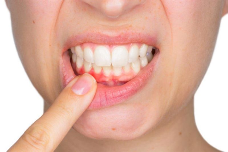 10 مشكلات شائعة للأسنان يمكنكم التعامل معها ببساطة