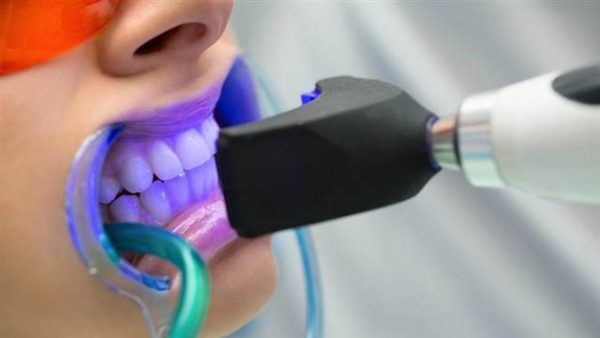 أخصائية توضح حقائق هامة عن “تبييض الأسنان”
