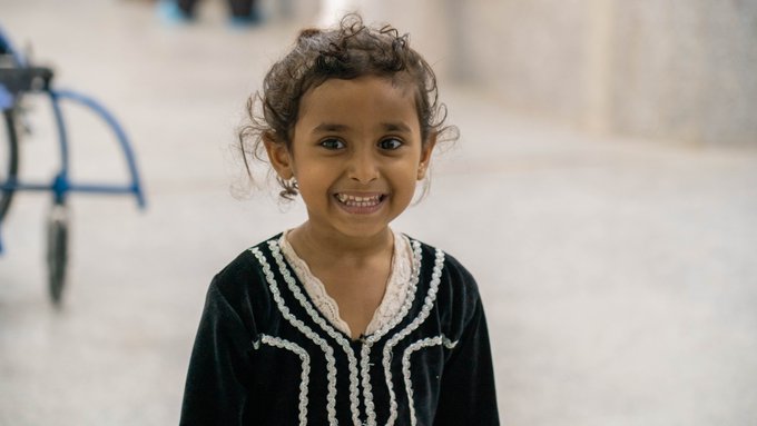 2 مليون طفل يمني يعانون من الهزال