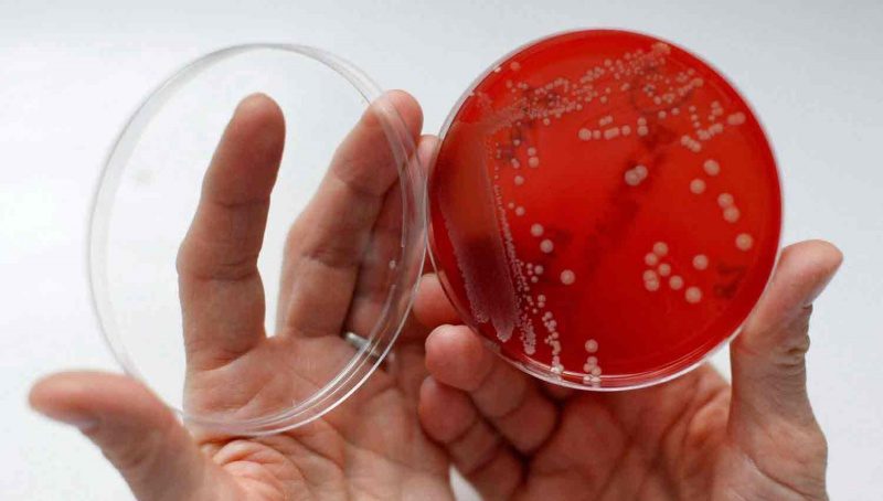 عقار جديد مضاد للعدوى البكتيرية .. ليس له شبيه