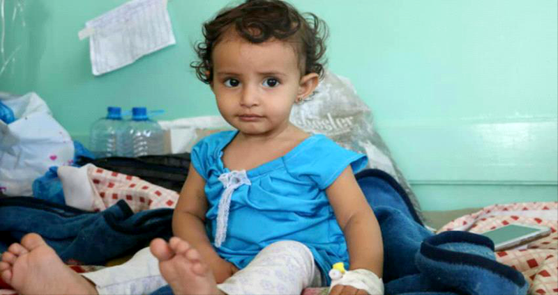تحذيرات أممية جديدة من انتشار هذا الوباء في جميع المحافظات اليمنية