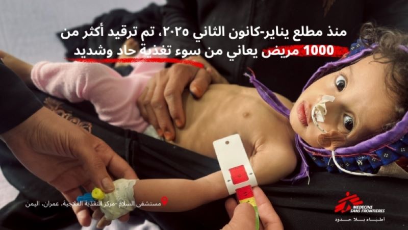 مديرية خمر تستقبل أكثر من 1000 مريض يعانون من سوء التغذية حاد