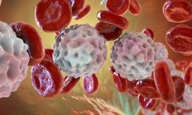 اكتشاف علاج واعد لأحد أخطر أنواع سرطان الدم
